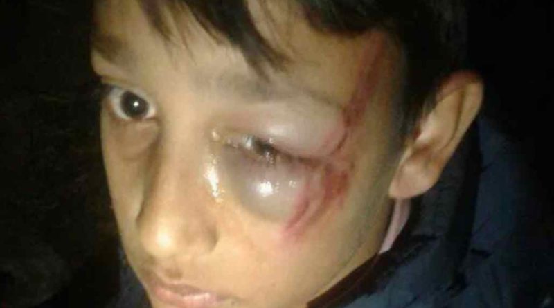 गृहकार्य नगरेको भनेर यसरी कुटिए विद्यार्थी