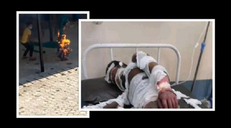 जागिर बाट हटाएको निहुमा आफ्नै शरीरमा आगो लगाएका बयलपाटा अस्पतालका कर्मचारीको मृत्यु